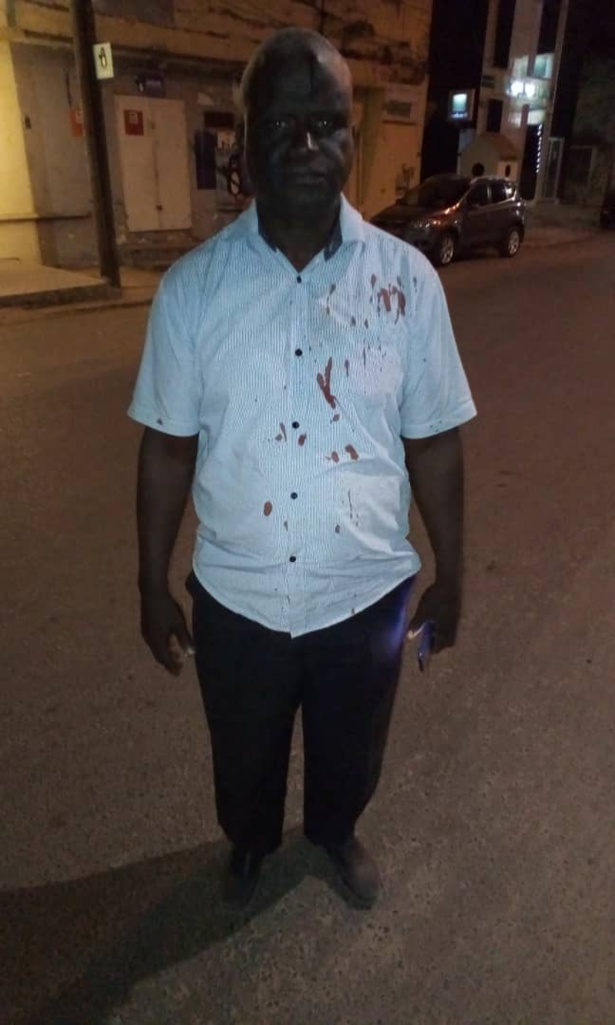  Agression d' Ousmane Coly: Abdou Sané de Pastef /Ziguinchor accuse le camp de Baldé